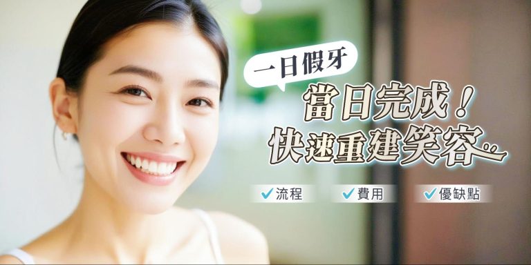 一日假牙當日完成！流程、費用、優缺點一次看！快速重建笑容