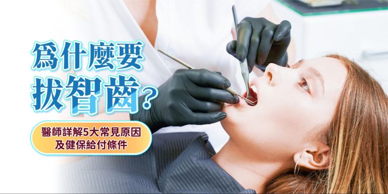 為什麼要拔智齒？醫師詳解5大常見原因及健保給付條件