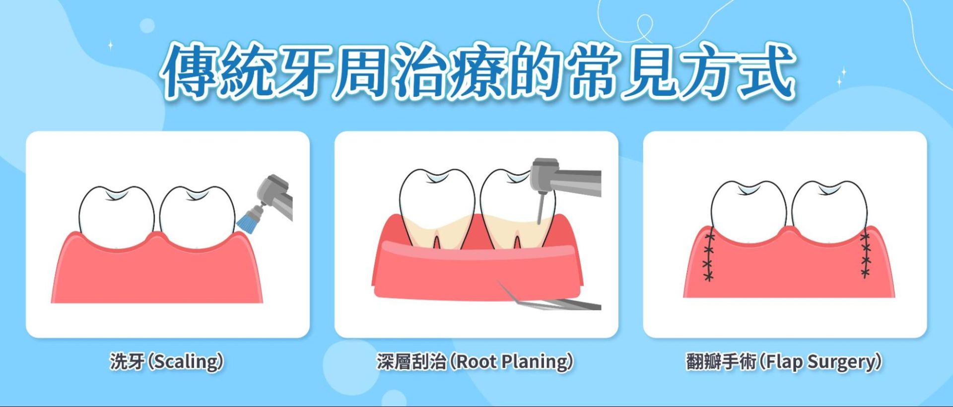 傳統牙周治療的常見方式