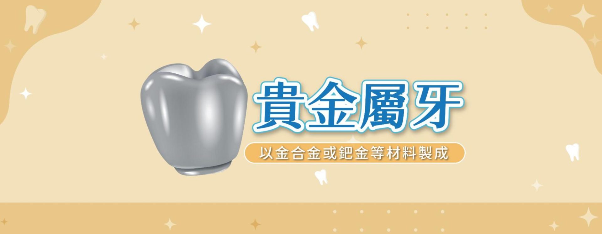 貴金屬牙(黃金、鈀金)|價格高但耐用與生物相容性強