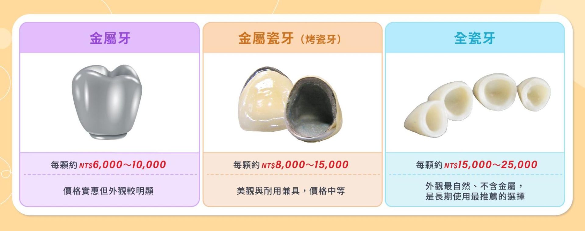 全瓷牙/金屬瓷牙/金屬牙費