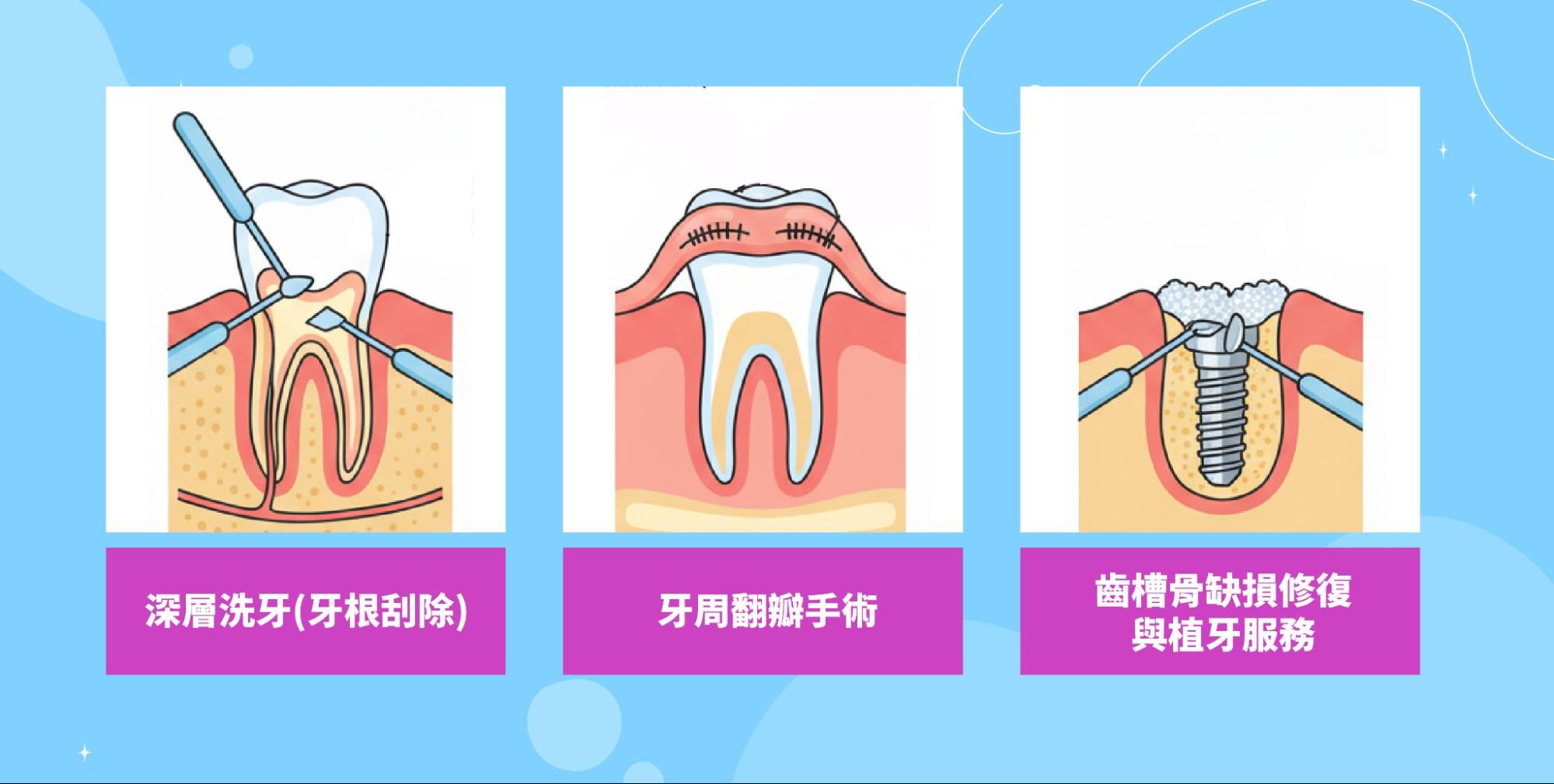 泰豐牙醫牙周治療服務介紹
