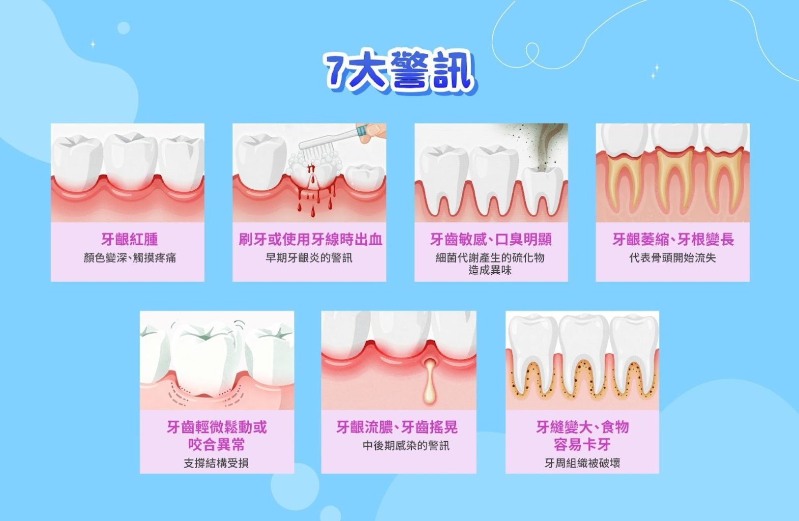 牙周病自我檢查:7大警訊
