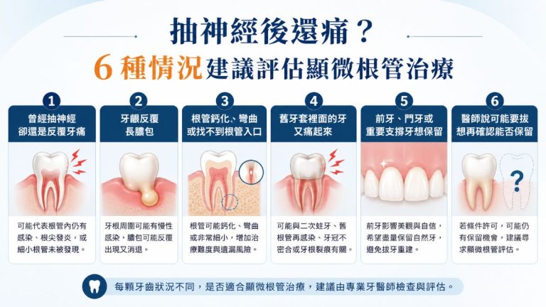 抽神經後還痛?6種情況建議評估顯微根管治療
