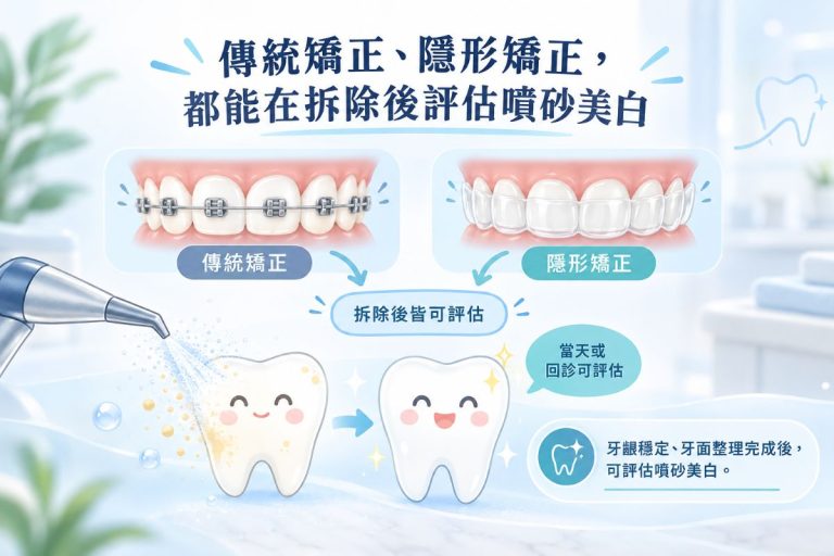 傳統矯正、隱形矯正，都能在拆除後評估噴砂美白